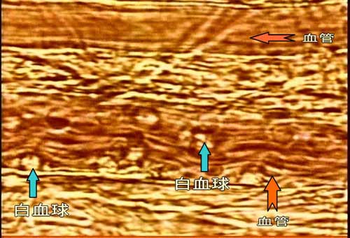 造影写真-血管と白血球